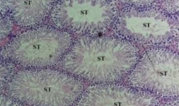 فوتومیکروگراف نوری از مقطع بافت Testes رنگ‌آمیزی H&E