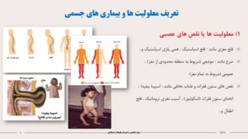 پاورپوینت کودکان استثنایی