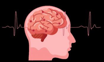 تست هوشمند دیداری و شنیداری iv2a