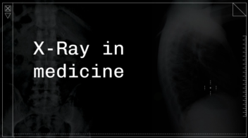 پاورپوینت    X-Ray in medicine