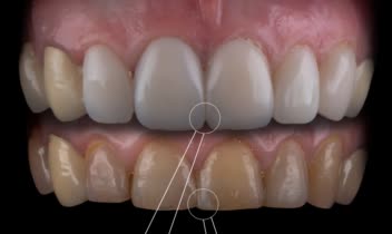 نمونه کار طراحی پست اسلاید شماره ۲