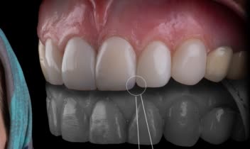 نمونه کار طراحی پست اسلاید شماره ۲