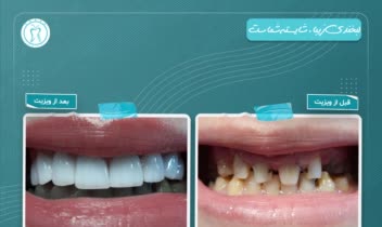 طراحی پست و استوری شبکه های اجتماعی دندان پزشکی
