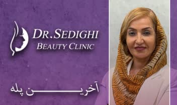 بنر استند چاپی | Advertising Banner
