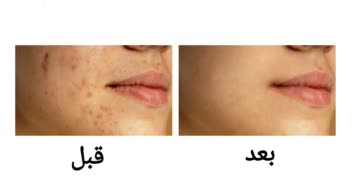 ادیت و روتوش چهره با برنامه فتوشاپ