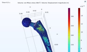 hip implant analysis مفصل ران، مهندسی پزشکی