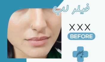 نمونه کار پزشک زیبایی برای اینستاگرام