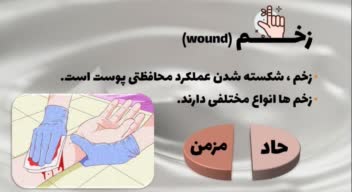 پاورپوینت ارائه - تولید کرم زخم - جشنواره خارزمی
