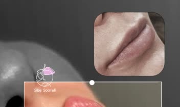 بنر استوری،استوری تخفیف،جشنواره و لیست قیمت و نمونه کار های کلینیک زیبایی