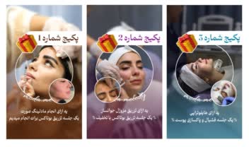 استوری برای معرفی پکیج و تخفیف