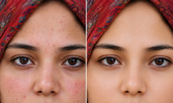 روتوش حرفه‌ای و اصلاح چهره شما