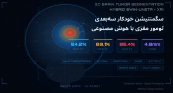 سگمنتیشن خودکار سه‌بعدی تومور مغزی در تصاویر MRI چندمودالیتی با استفاده از معماری هیبرید Swin Transformer-CNN و هوش مصنوعی قابل تفسیر