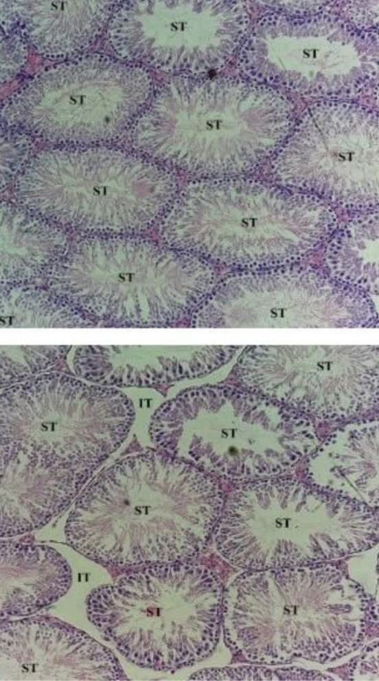 فوتومیکروگراف نوری از مقطع بافت Testes رنگ‌آمیزی H&E