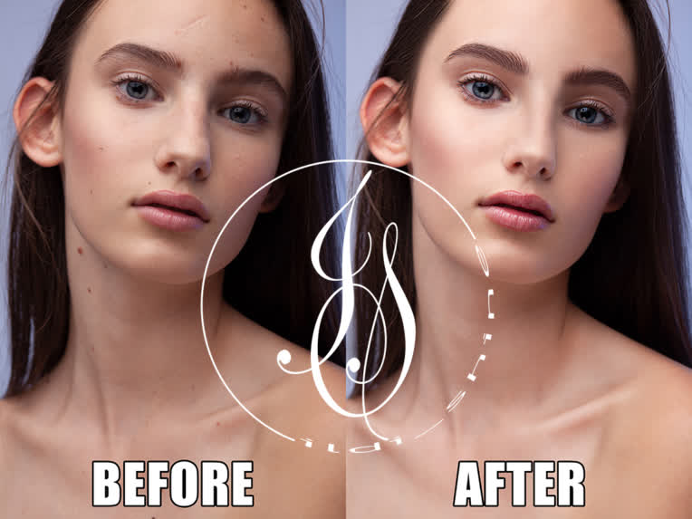 S 1 B&A.jpg