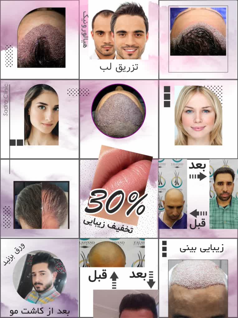 نمونه آخر.jpg