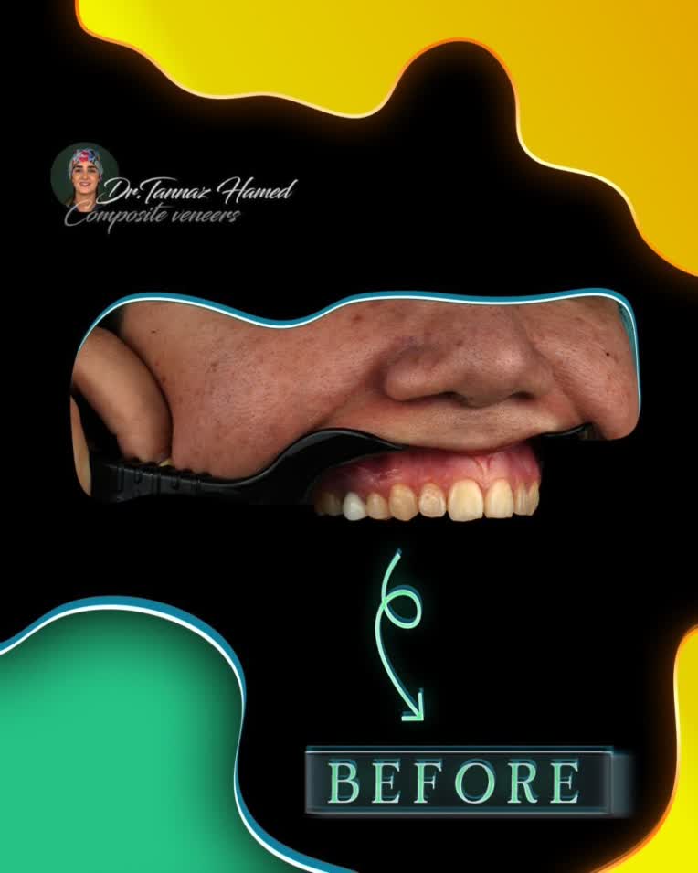 نمونه کار طراحی پست اسلاید شماره ۱