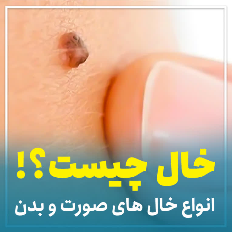 تولید محتوا و طراحی برای پیج دکتر علی مرزوقی