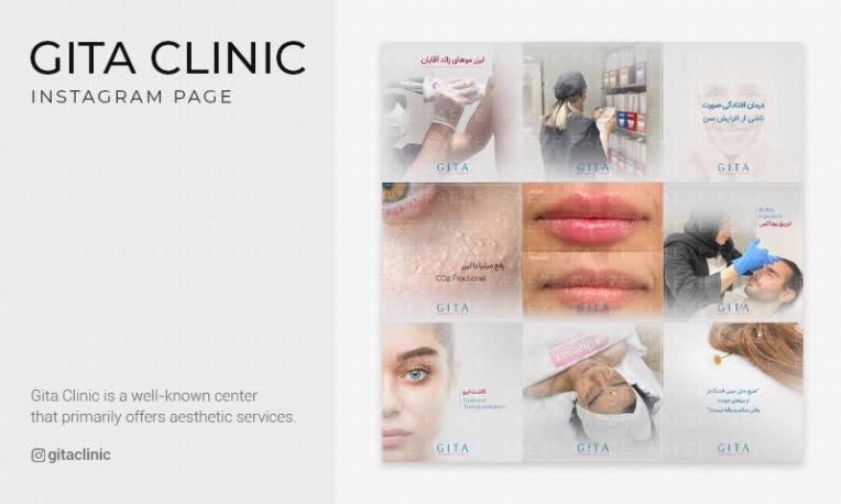 طراحی اینستاگرام کلینیک پوست، مو و زیبایی گیتا