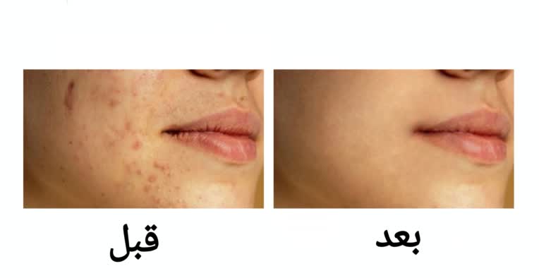 ادیت و روتوش چهره با برنامه فتوشاپ