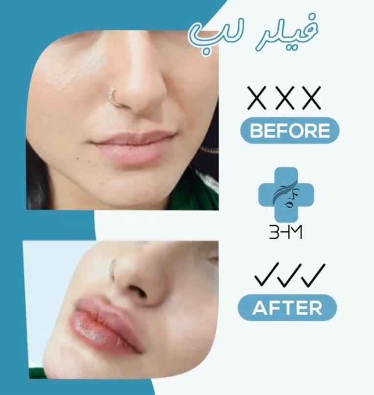 نمونه کار پزشک زیبایی برای اینستاگرام