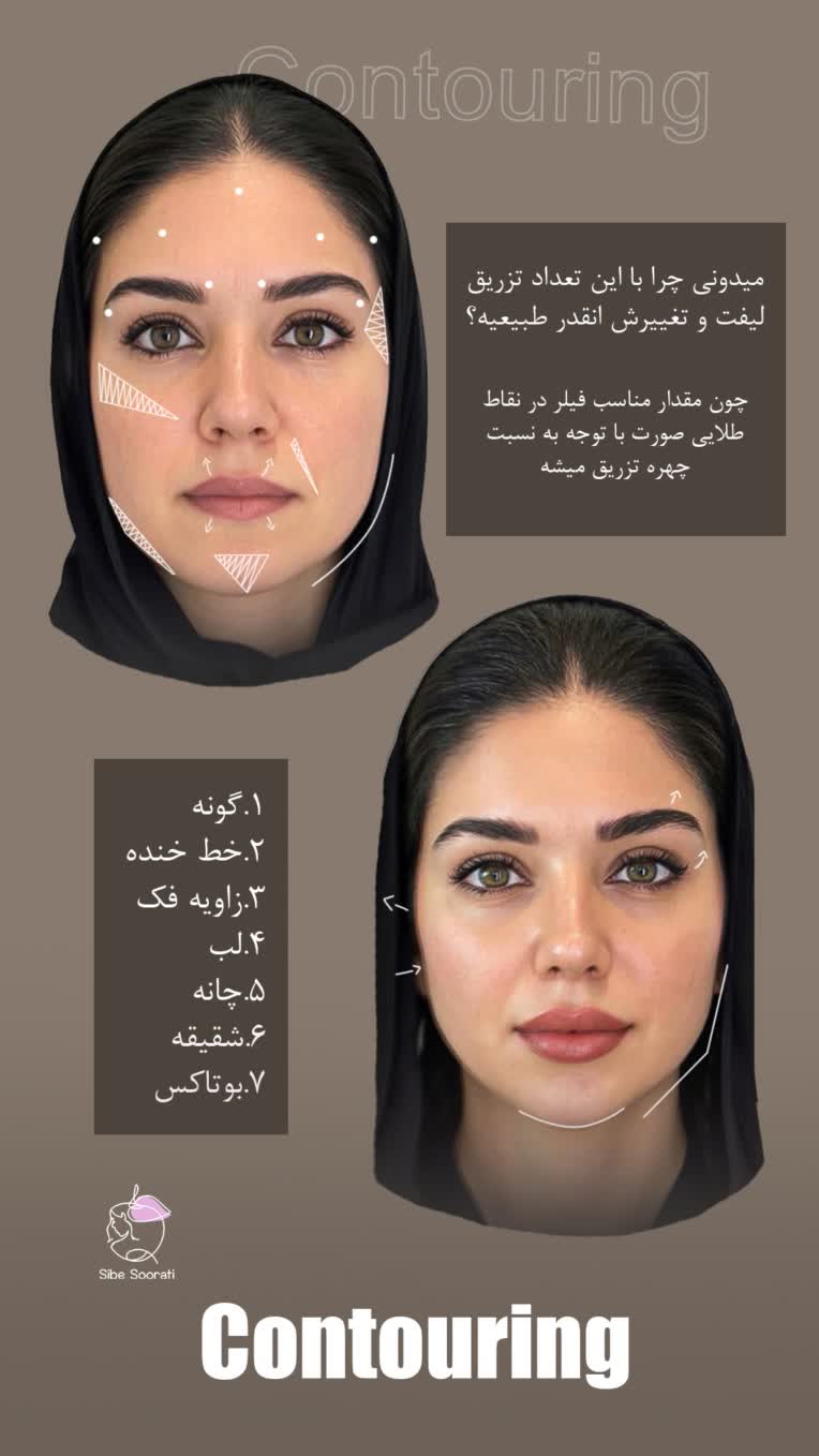 بنر استوری،استوری تخفیف،جشنواره و لیست قیمت و نمونه کار های کلینیک زیبایی