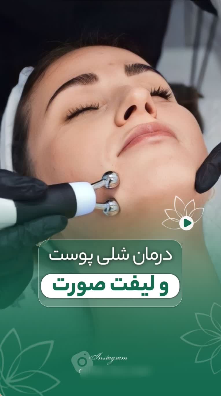 کاور پست ریلز اینستاگرام برای پیج کاری