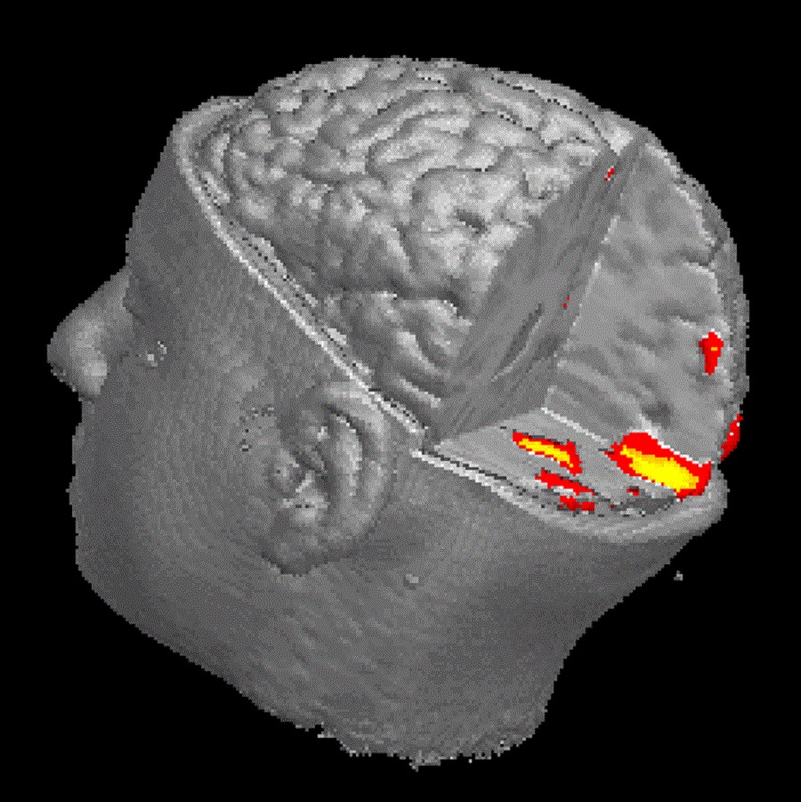 FMRI